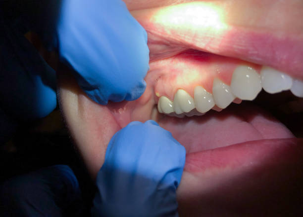 Best Dentist Open Late Near Me  in Newington, VA