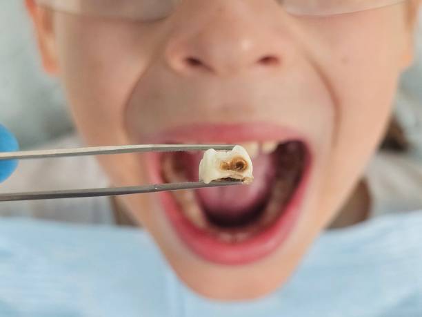 Best Urgent Tooth Repair  in Newington, VA